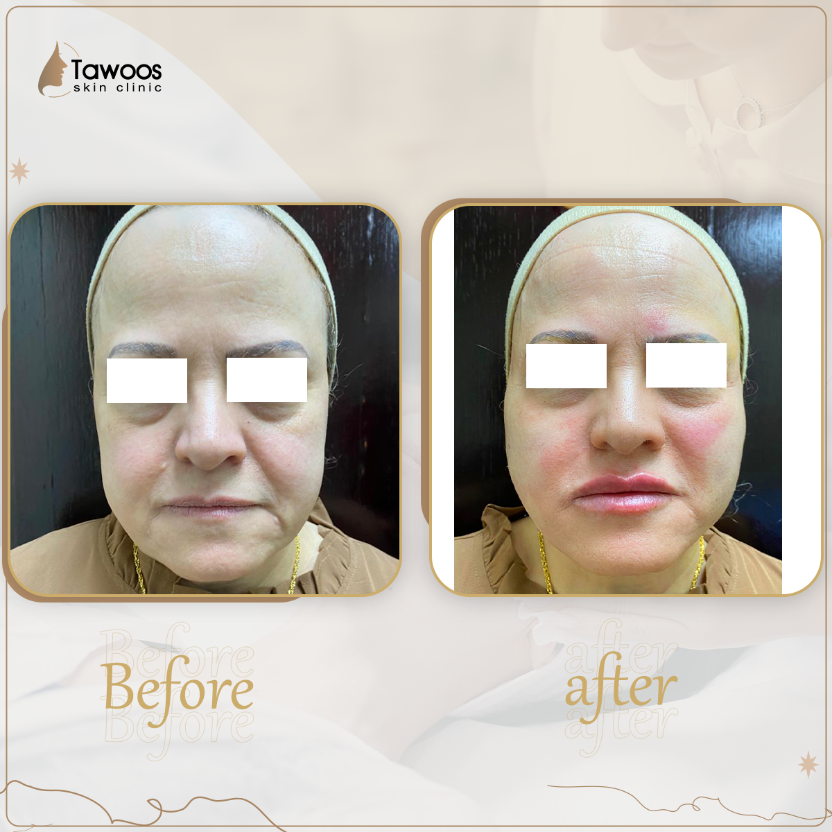 tawoos clinic
