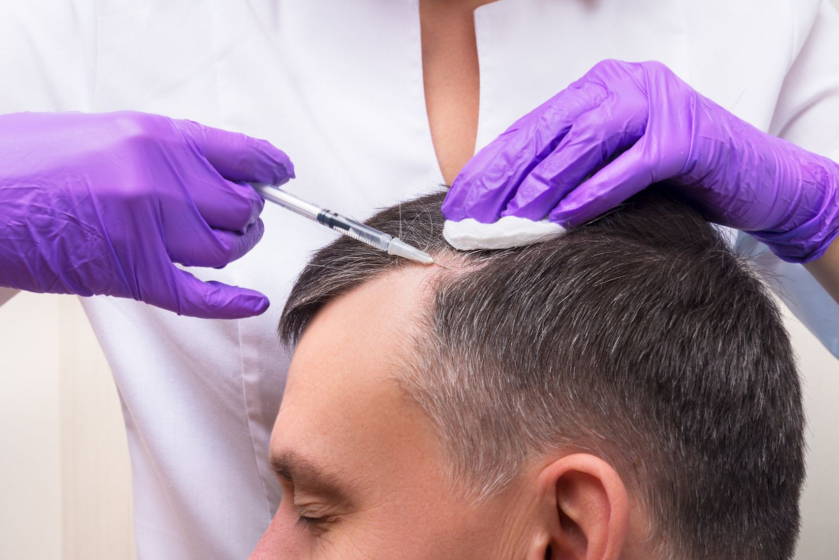 Hair Transplantation By FUE